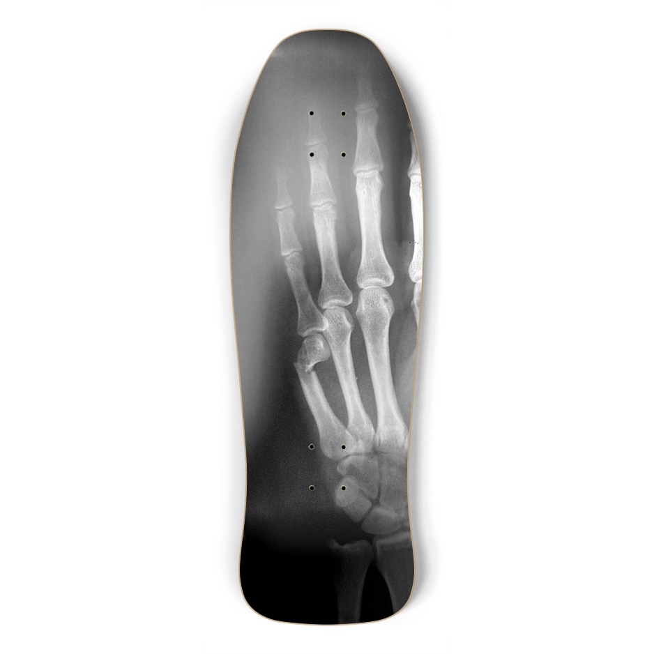 Koda’s xray
