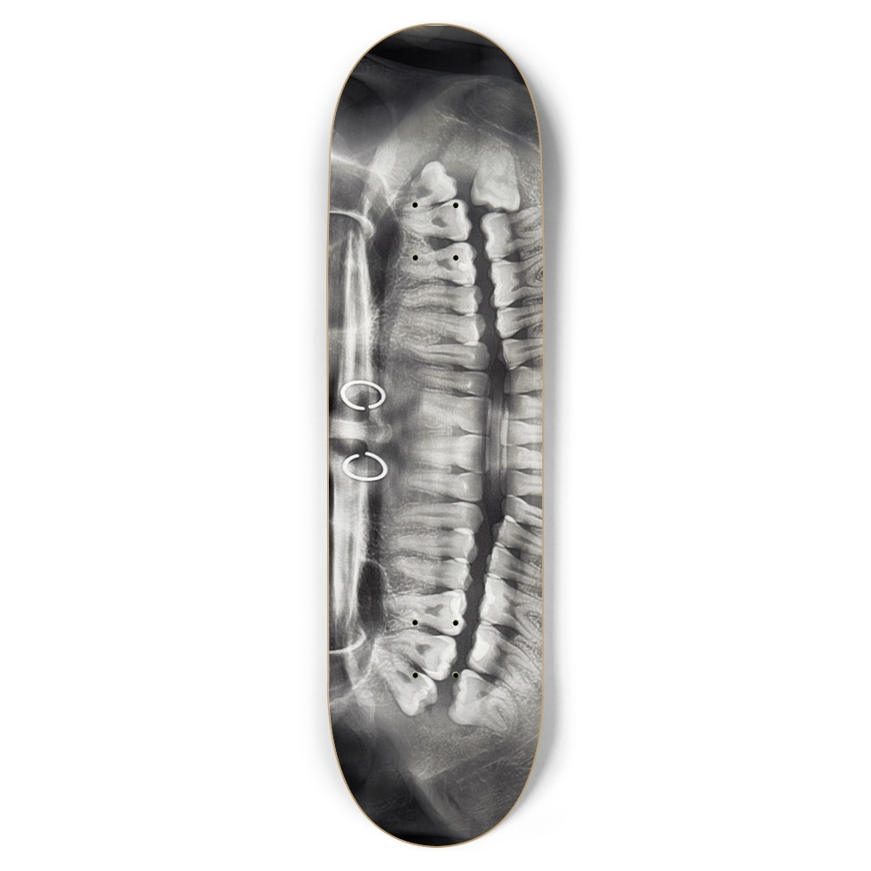 Lamesk8 teef xray