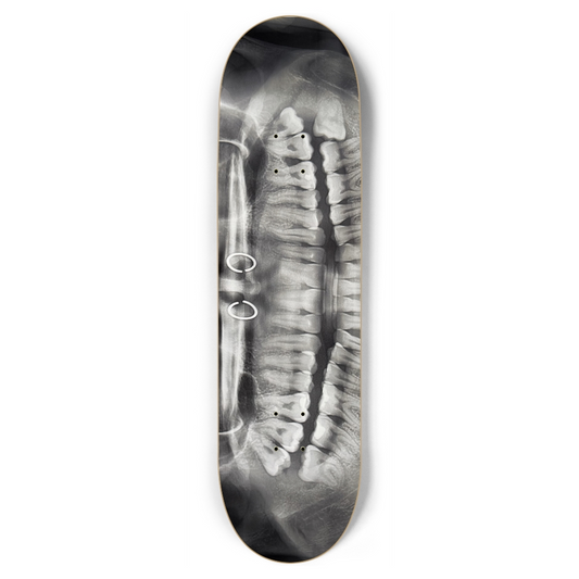 Lamesk8 teef xray